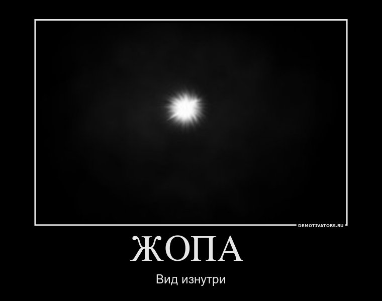 zhopa-.jpg