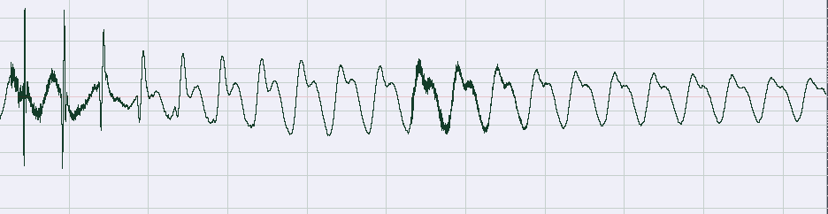 upload_2019-6-19_18-49-37.png