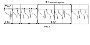 б.Терция -аудиограмма.png